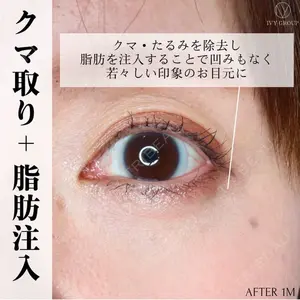 吉祥寺アイビークリニック 升本　浩紀医師の症例