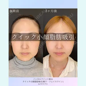 ルラ美容クリニック 札幌院 佐藤 雄紀医師の症例