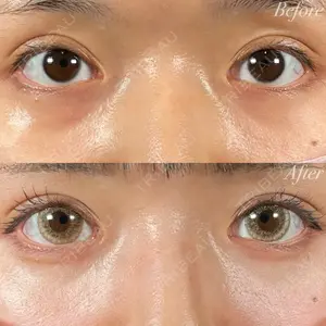 R Beauty CLINIC 名古屋院 木村 尚大医師の症例