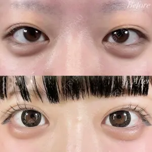 R Beauty CLINIC 銀座院 富田 莉沙子医師の症例