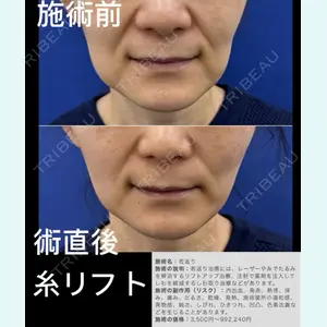 症例