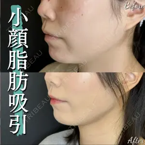 ルラ美容クリニック 大宮院 右京 大季医師の症例