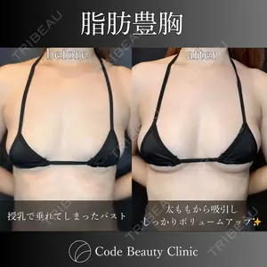 Code Beauty Clinic 名古屋院の症例