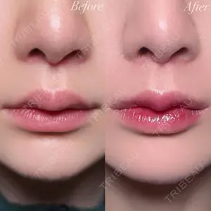 R Beauty CLINIC 銀座院 村山史朗医師の症例