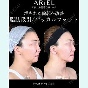 アリエル美容クリニック 大宮院 鈴木　桂介医師の症例
