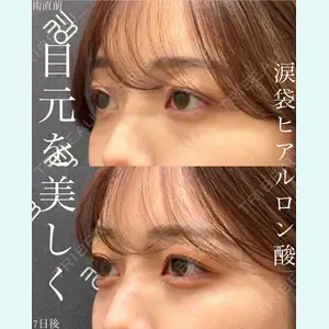 症例