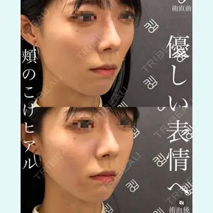 EMMO FACE CLINIC 大宮院 廣松 直樹医師の症例