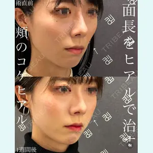 EMMO FACE CLINIC 大宮院 廣松 直樹医師の症例