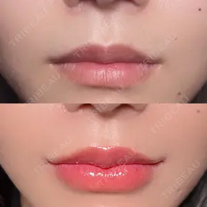 R Beauty CLINIC 銀座院 村山史朗医師の症例