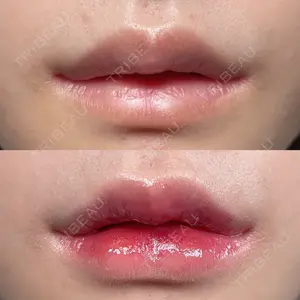R Beauty CLINIC 銀座院 村山史朗医師の症例