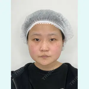 フローラクリニック 秋間雄策（さくちゃん先生）医師の症例