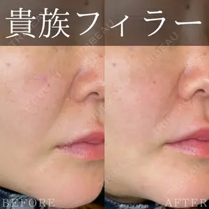 ルラ美容クリニック 大宮院 右京 大季医師の症例