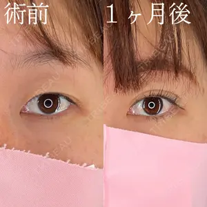 症例
