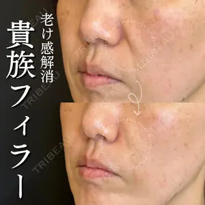 ルラ美容クリニック 大宮院 右京 大季医師の症例