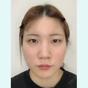 フローラクリニック 秋間雄策（さくちゃん先生）医師の症例