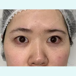 フローラクリニック 秋間雄策（さくちゃん先生）医師の症例