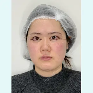 フローラクリニック 秋間雄策（さくちゃん先生）医師の症例