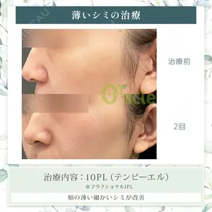 オラクル美容皮膚科 東京新宿院の症例