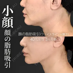 症例
