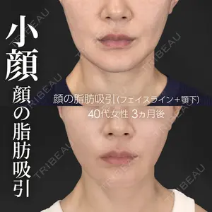 症例