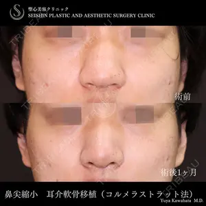 聖心美容クリニック 六本木院 川端 優也医師の症例