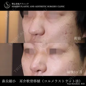 聖心美容クリニック 六本木院 川端 優也医師の症例