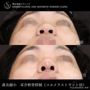聖心美容クリニック 六本木院 川端 優也医師の症例