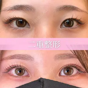症例