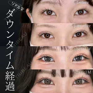 症例