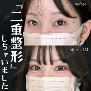 症例