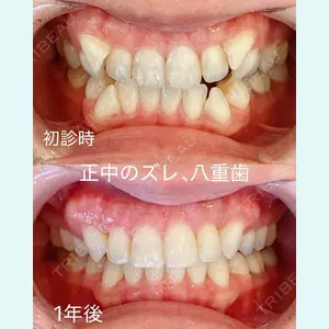 RIVER CLINIC DENTAL 古居 憲医師の症例