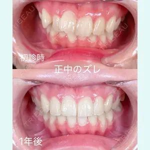 RIVER CLINIC DENTAL 古居 憲医師の症例