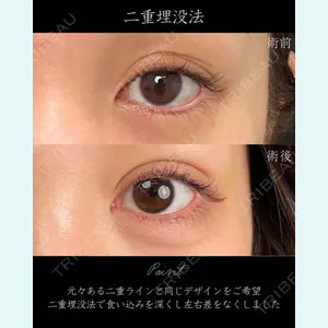 症例
