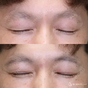 聖心美容クリニック 名古屋院 加藤 大典医師の症例