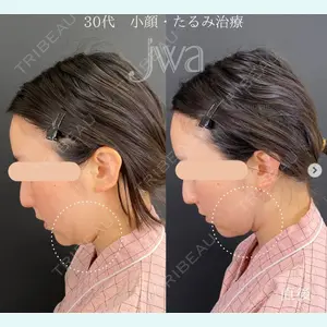 自由が丘ウェルエイジングビューティークリニック 福田 知佐子医師の症例