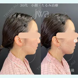 自由が丘ウェルエイジングビューティークリニック 福田 知佐子医師の症例