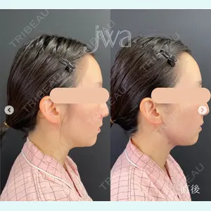 自由が丘ウェルエイジングビューティークリニック 福田 知佐子医師の症例
