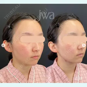 自由が丘ウェルエイジングビューティークリニック 福田 知佐子医師の症例