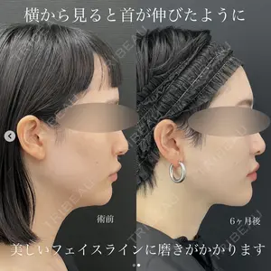症例