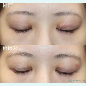 症例
