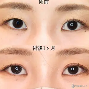 症例