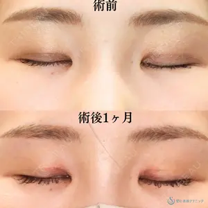 症例