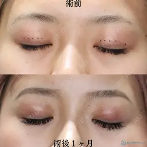 症例