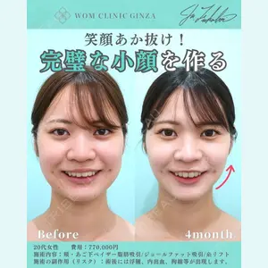 WOM CLINIC GINZA （ワム クリニック ギンザ） 深堀 純也医師の症例