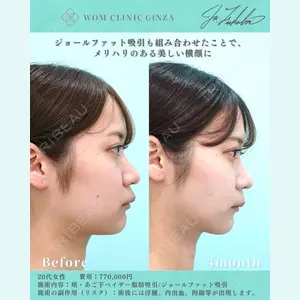 WOM CLINIC GINZA （ワム クリニック ギンザ） 深堀 純也医師の症例