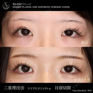 聖心美容クリニック 六本木院 川端 優也医師の症例