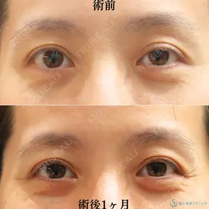 症例