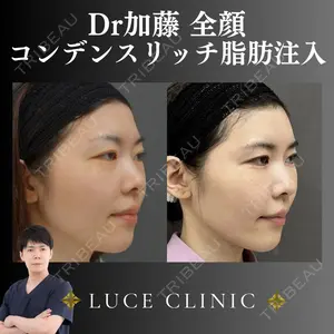 ルーチェクリニック 銀座院 加藤晴之輔医師の症例