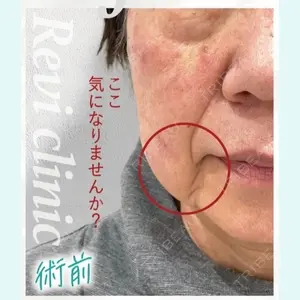 症例