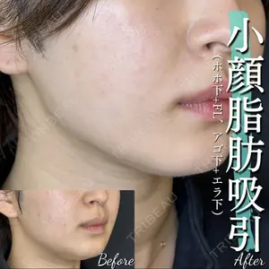 ルラ美容クリニック 大宮院 右京 大季医師の症例